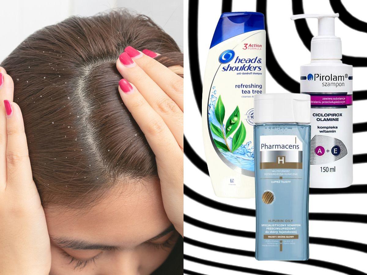 szampon dla kobiet przeciwłupieżowy